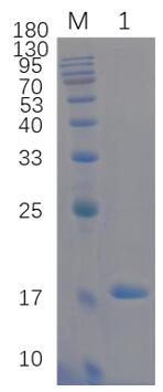 12% reducing SDS-PAGE analysis of purified PFN1-C71G (approximately 1 mg protein loaded).